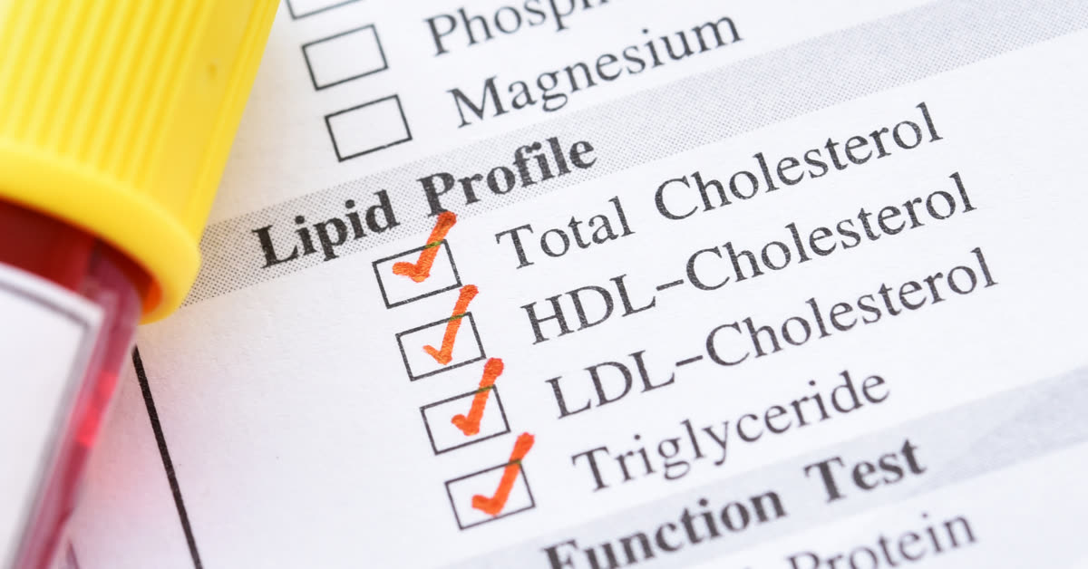 Laborbefund mit Lipidprofil: Gesamtcholesterin, HDL-Cholesterin, LDL-Cholesterin und Triglyceride angekreuzt